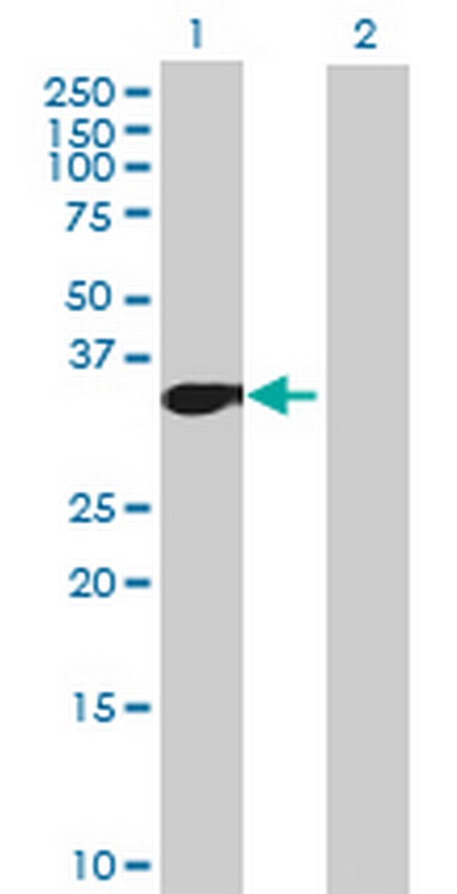 MLLT6 Antibody in Western Blot (WB)