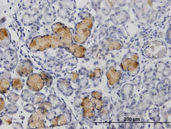 MMP1 Antibody in Immunohistochemistry (Paraffin) (IHC (P))