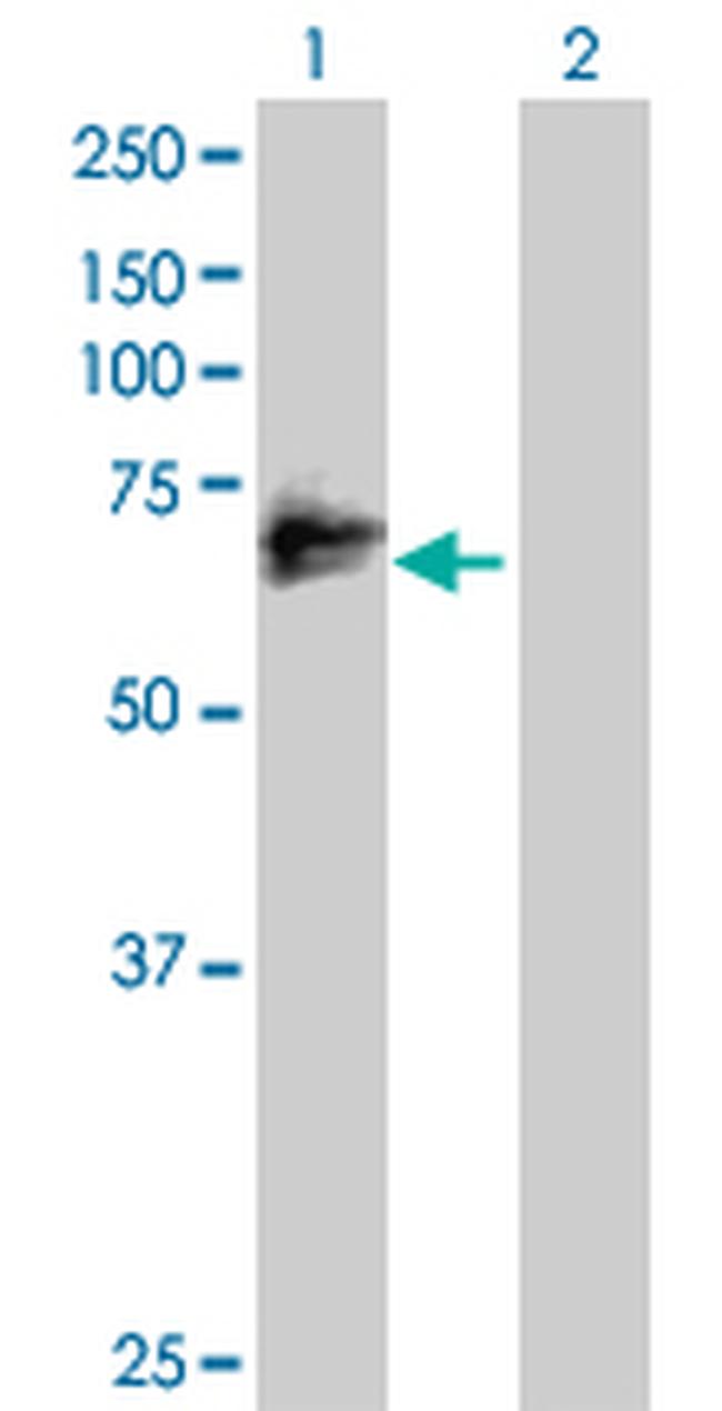 MMP2 Antibody in Western Blot (WB)