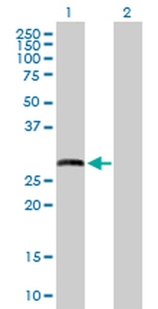 MMP7 Antibody in Western Blot (WB)