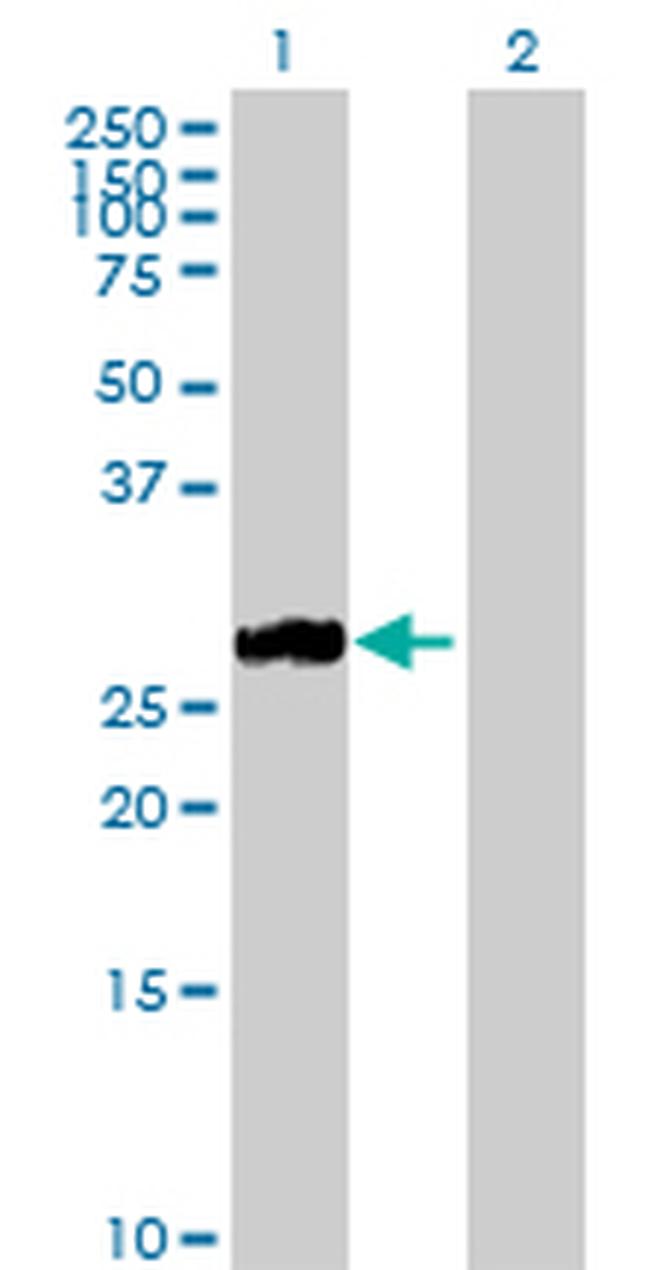 MMP7 Antibody in Western Blot (WB)