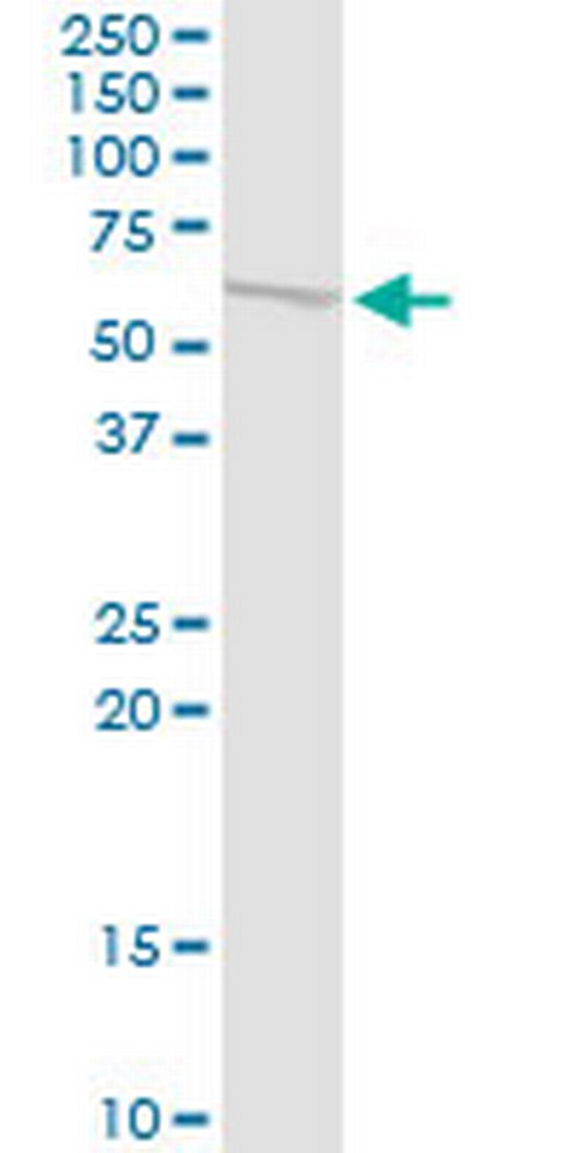 MMP10 Antibody in Western Blot (WB)