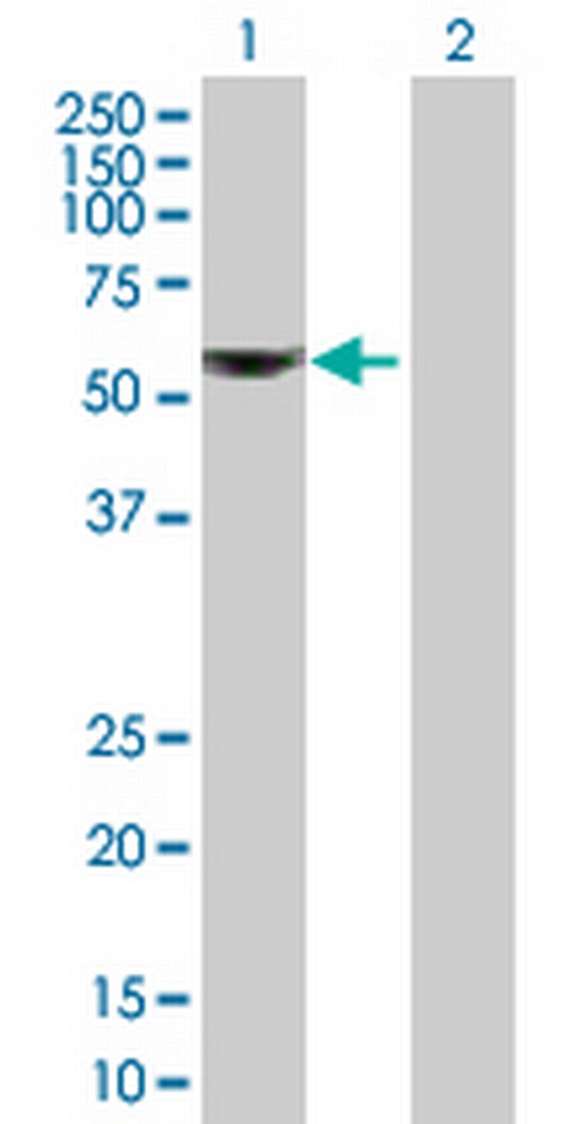 ALDH6A1 Antibody in Western Blot (WB)
