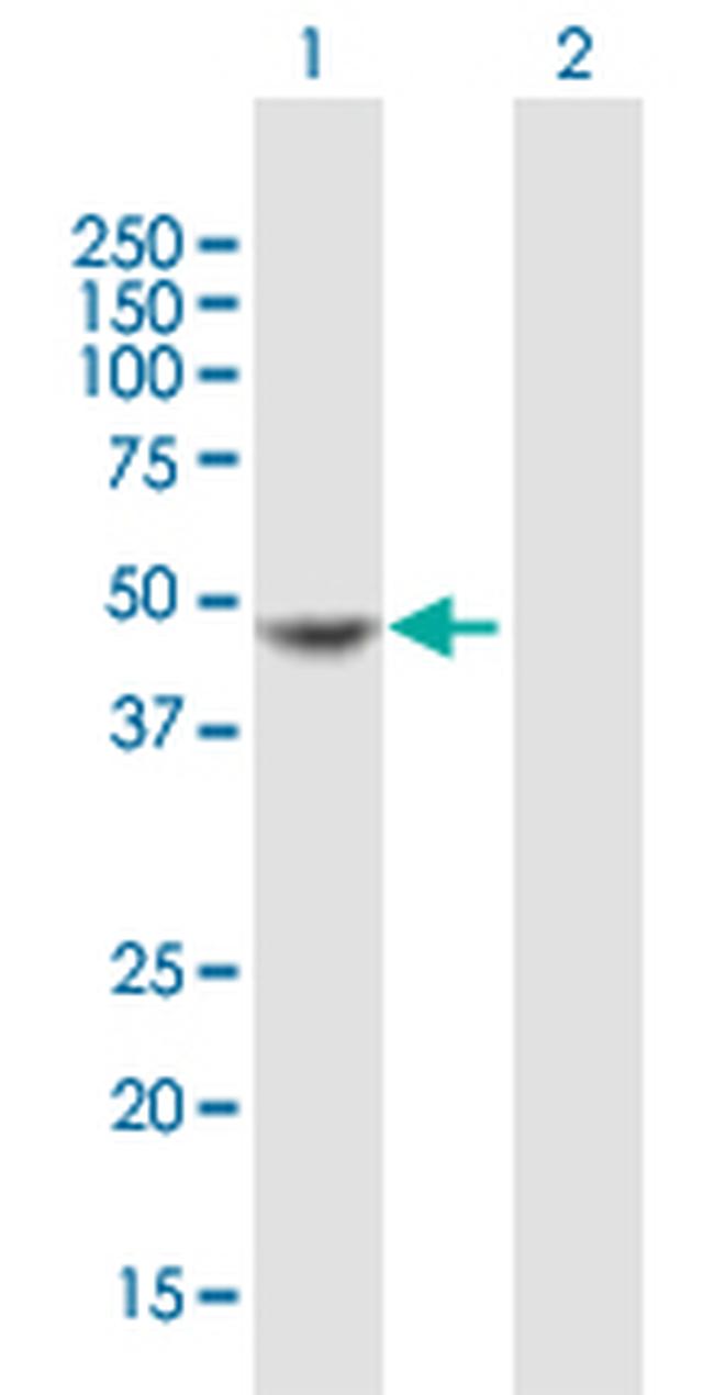 MPI Antibody in Western Blot (WB)