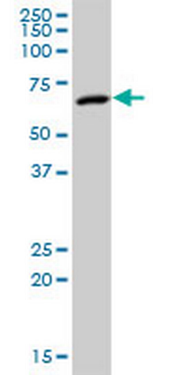 MPP2 Antibody in Western Blot (WB)