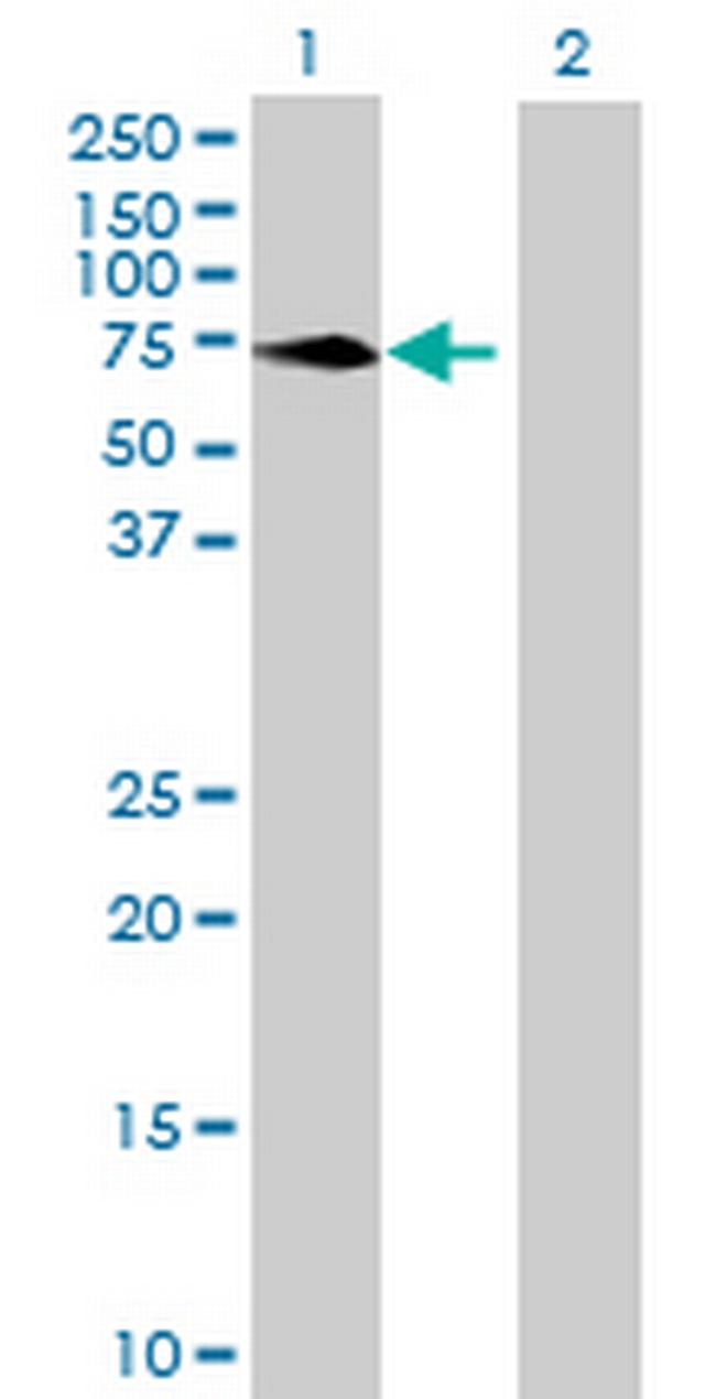 MPP3 Antibody in Western Blot (WB)