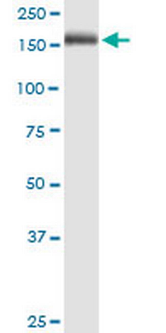 MRC1 Antibody in Western Blot (WB)