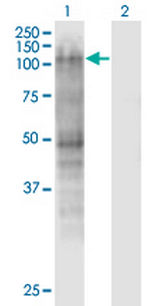 MSH2 Antibody in Western Blot (WB)