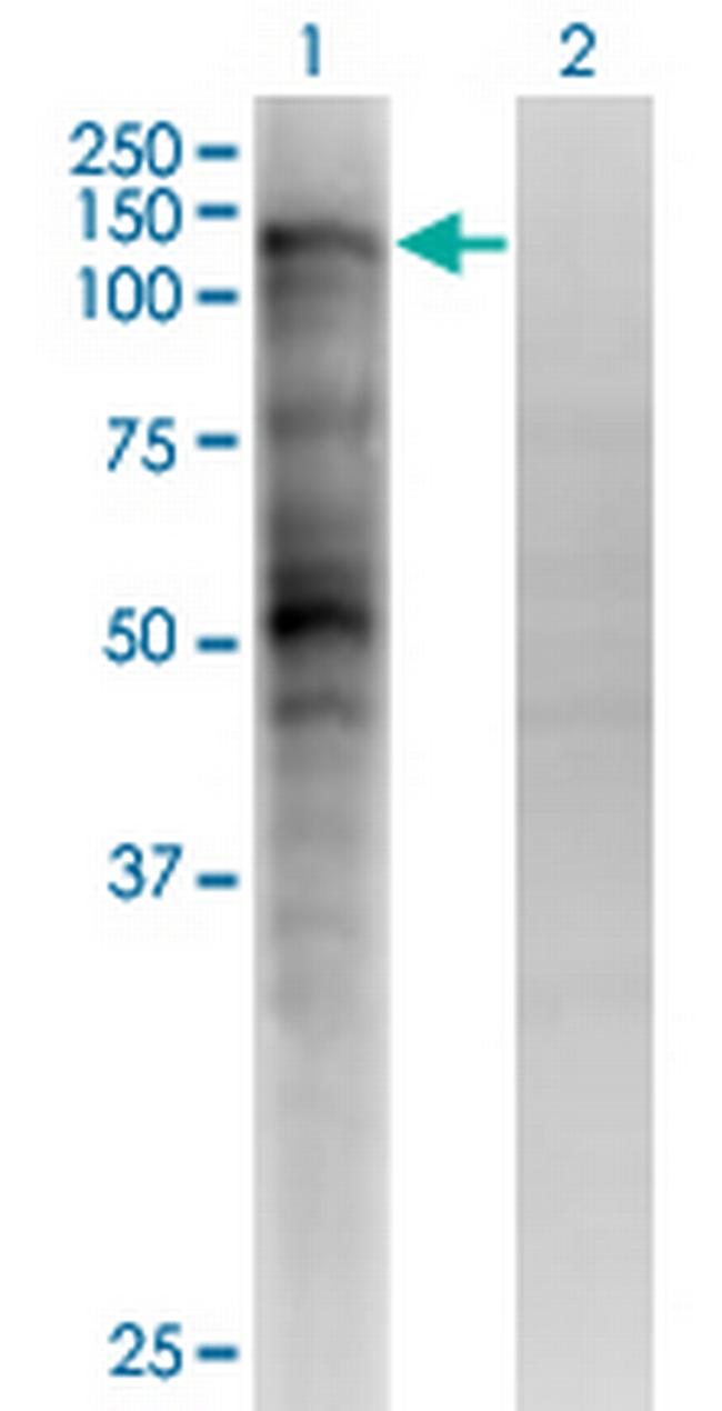 MSH2 Antibody in Western Blot (WB)