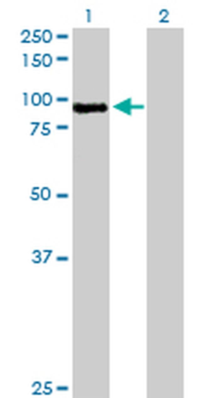 MST1 Antibody in Western Blot (WB)