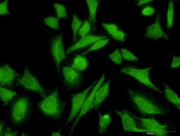 MTAP Antibody in Immunocytochemistry (ICC/IF)