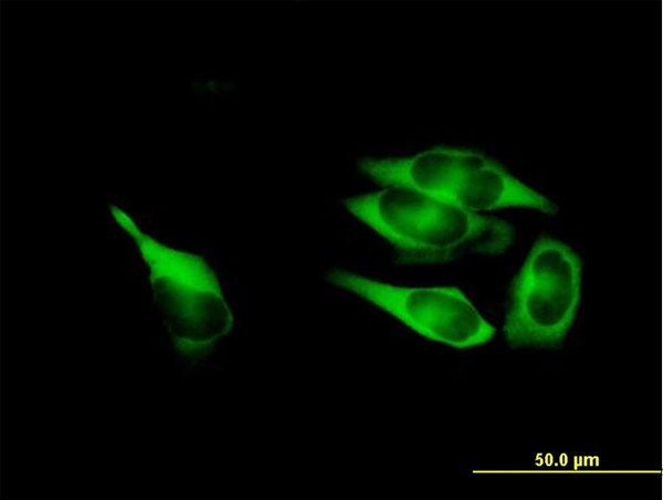 MTHFD1 Antibody in Immunocytochemistry (ICC/IF)