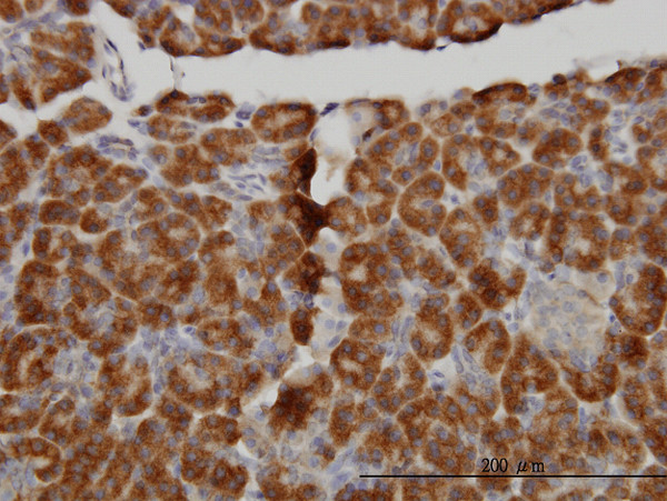 MTM1 Antibody in Immunohistochemistry (Paraffin) (IHC (P))