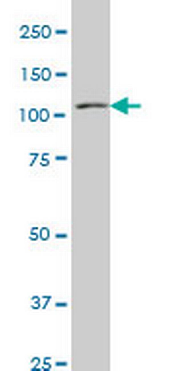 MUSK Antibody in Western Blot (WB)