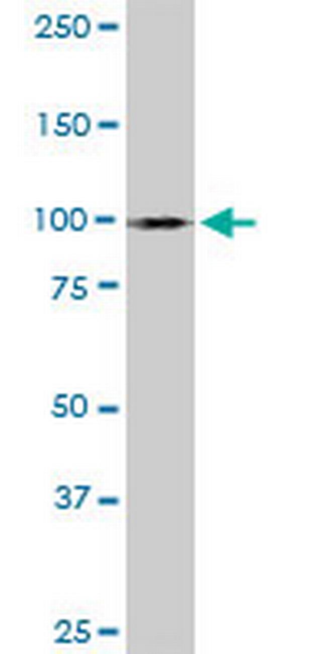 MYBL1 Antibody in Western Blot (WB)