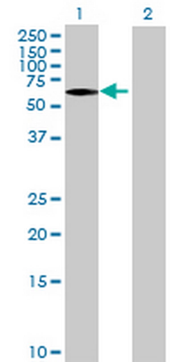 MYBPH Antibody in Western Blot (WB)