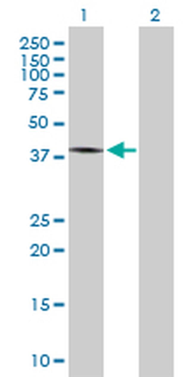 MYCN Antibody in Western Blot (WB)