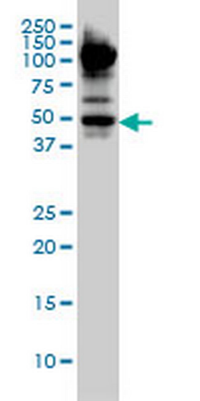 MYCN Antibody in Western Blot (WB)