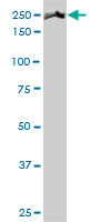 MYH9 Antibody in Western Blot (WB)