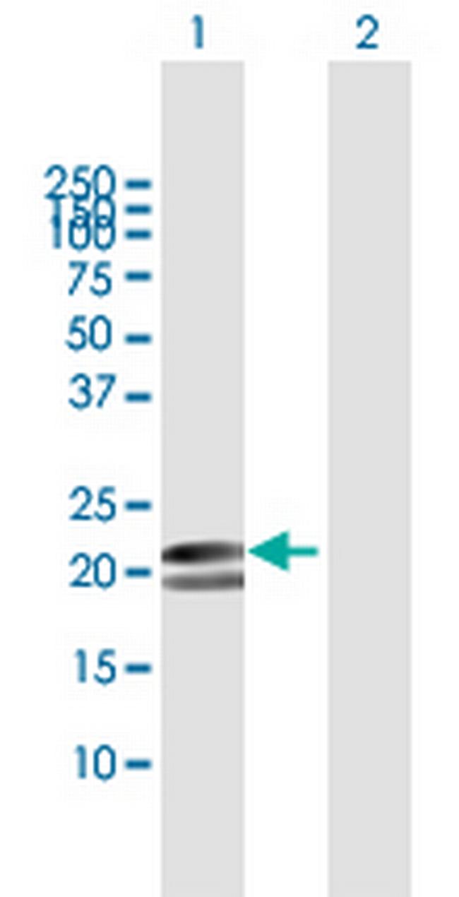 MYL1 Antibody in Western Blot (WB)