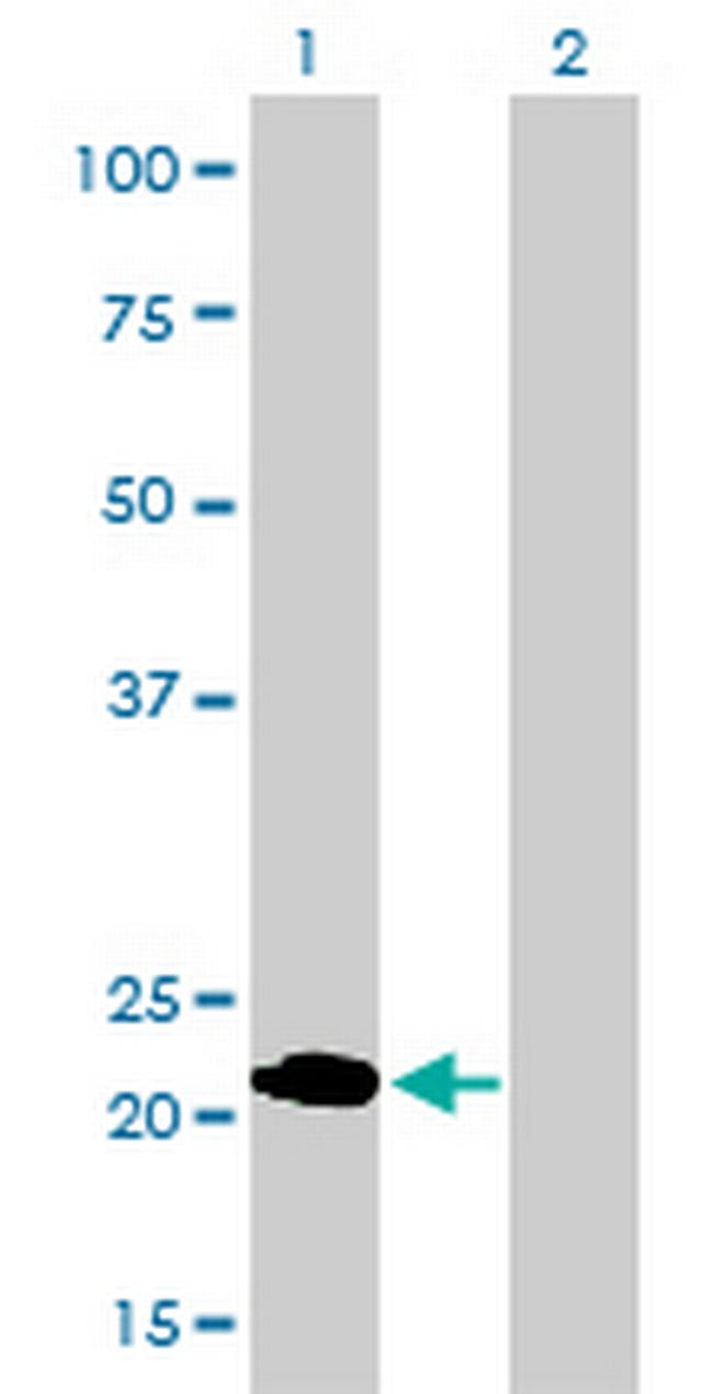 MYL1 Antibody in Western Blot (WB)