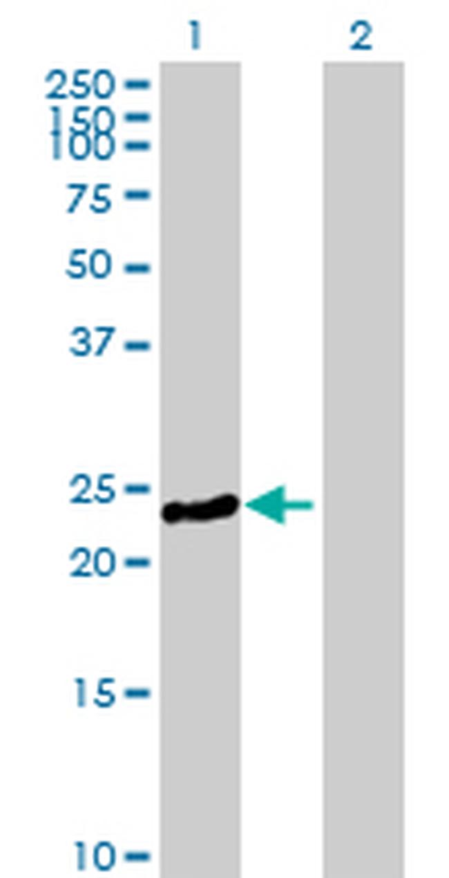 MYL3 Antibody in Western Blot (WB)