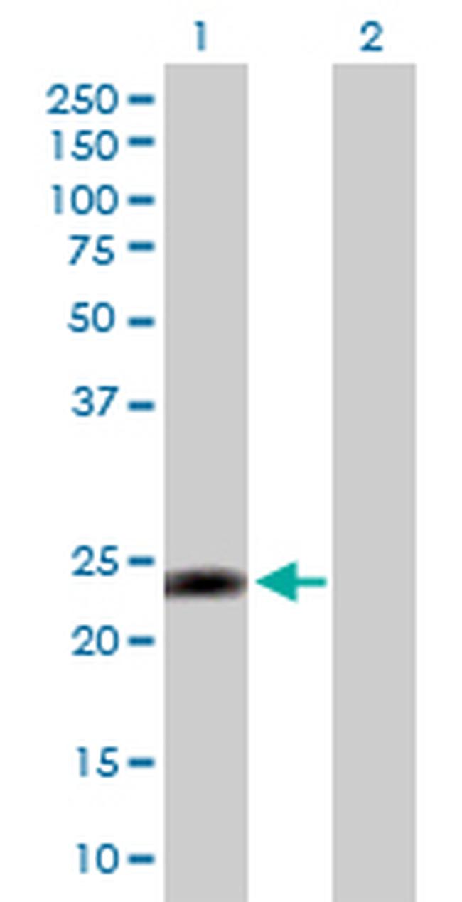MYL3 Antibody in Western Blot (WB)