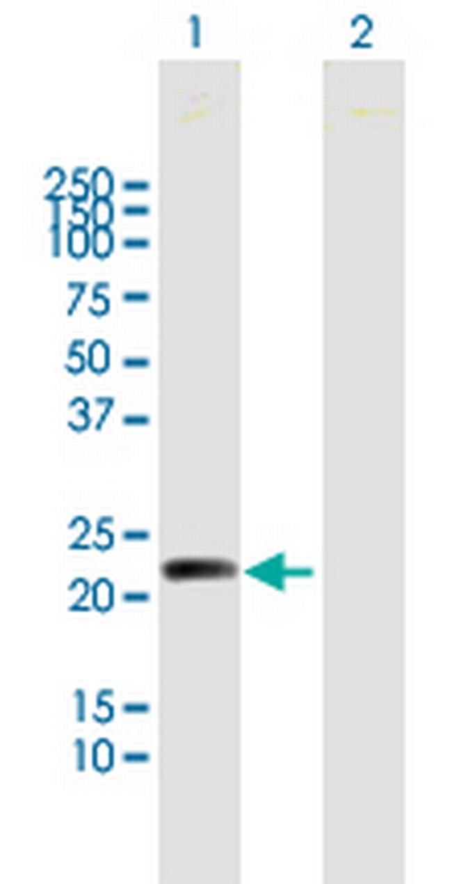 MYL5 Antibody in Western Blot (WB)