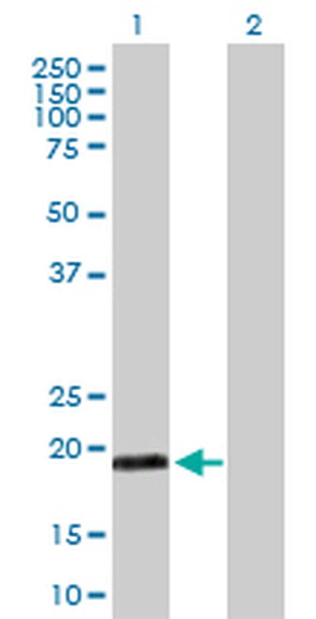 MYL5 Antibody in Western Blot (WB)