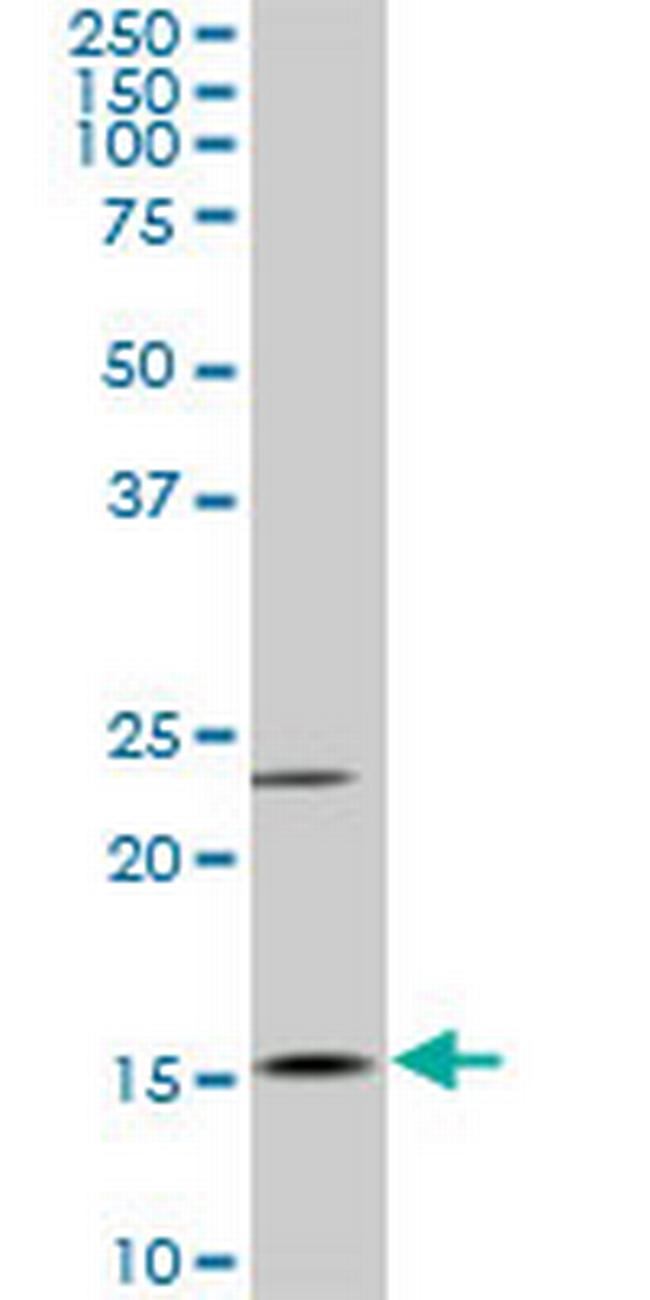 MYL6 Antibody in Western Blot (WB)
