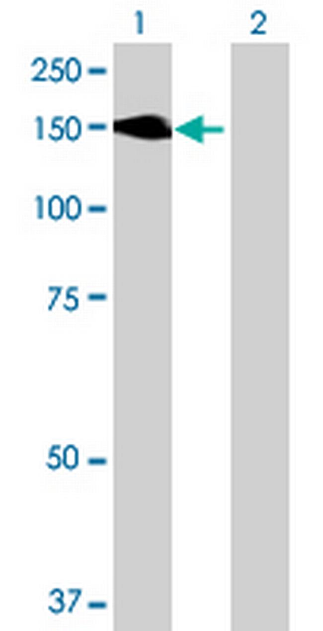 MYLK Antibody in Western Blot (WB)