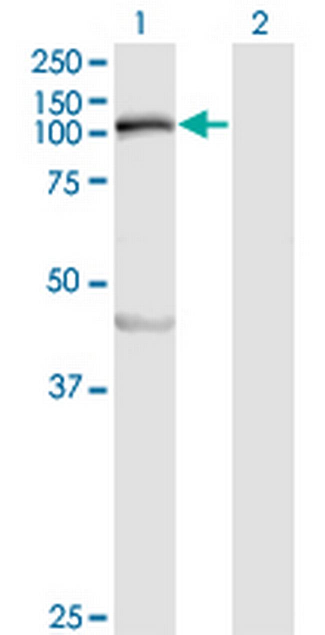 MYLK Antibody in Western Blot (WB)