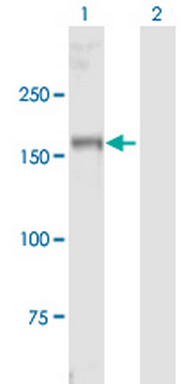 MYT1 Antibody in Western Blot (WB)