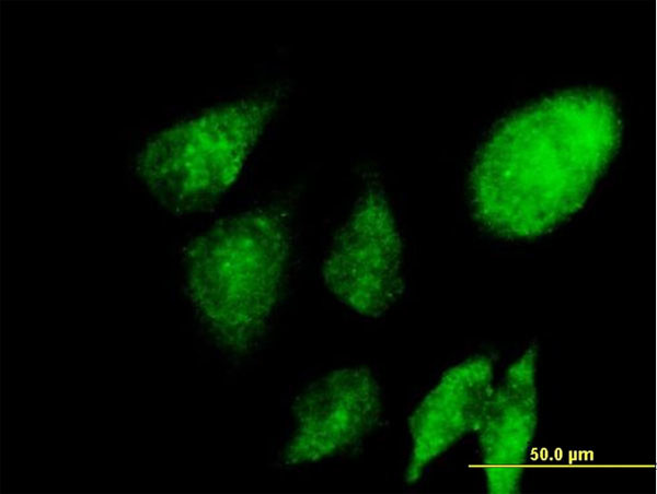 NACA Antibody in Immunocytochemistry (ICC/IF)