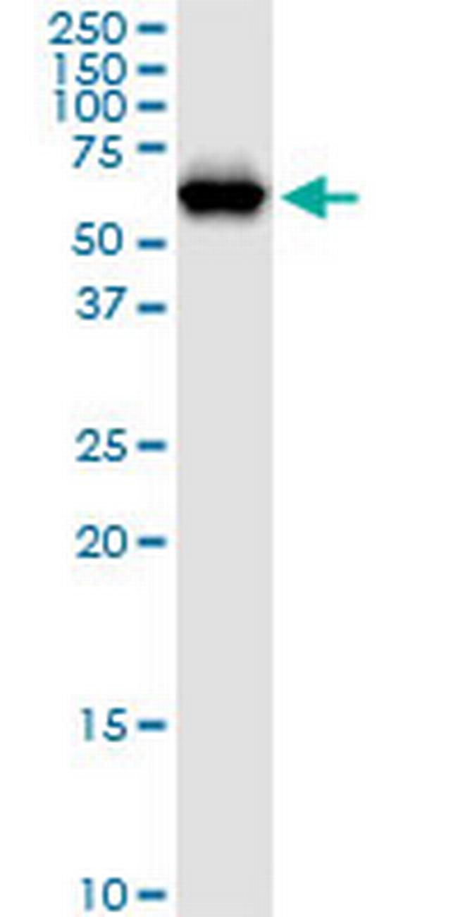 NARS Antibody in Western Blot (WB)