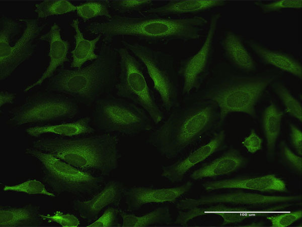 NARS Antibody in Immunocytochemistry (ICC/IF)
