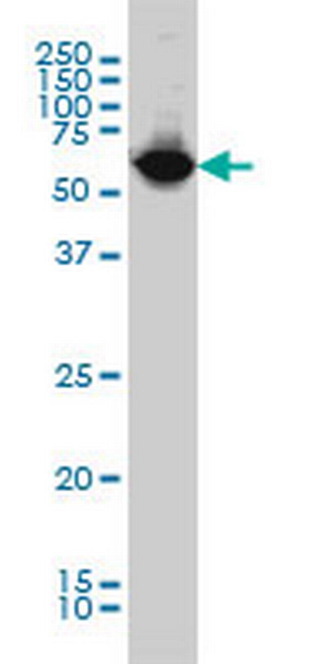 NARS Antibody in Western Blot (WB)