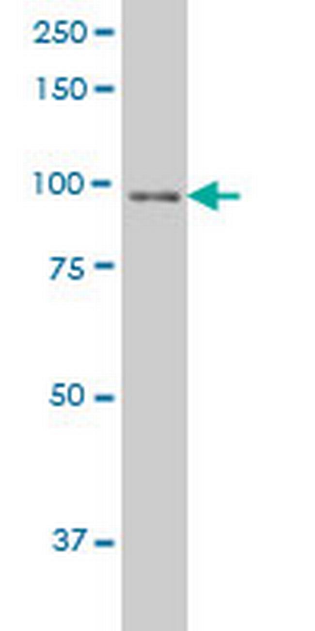 NBN Antibody in Western Blot (WB)
