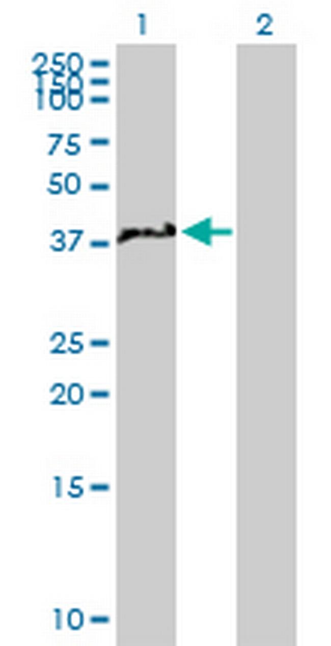 NCF4 Antibody in Western Blot (WB)