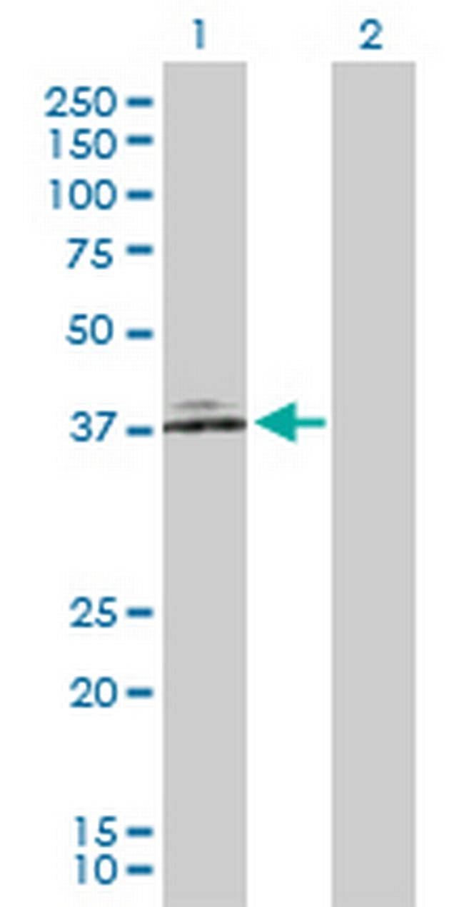 NCF4 Antibody in Western Blot (WB)