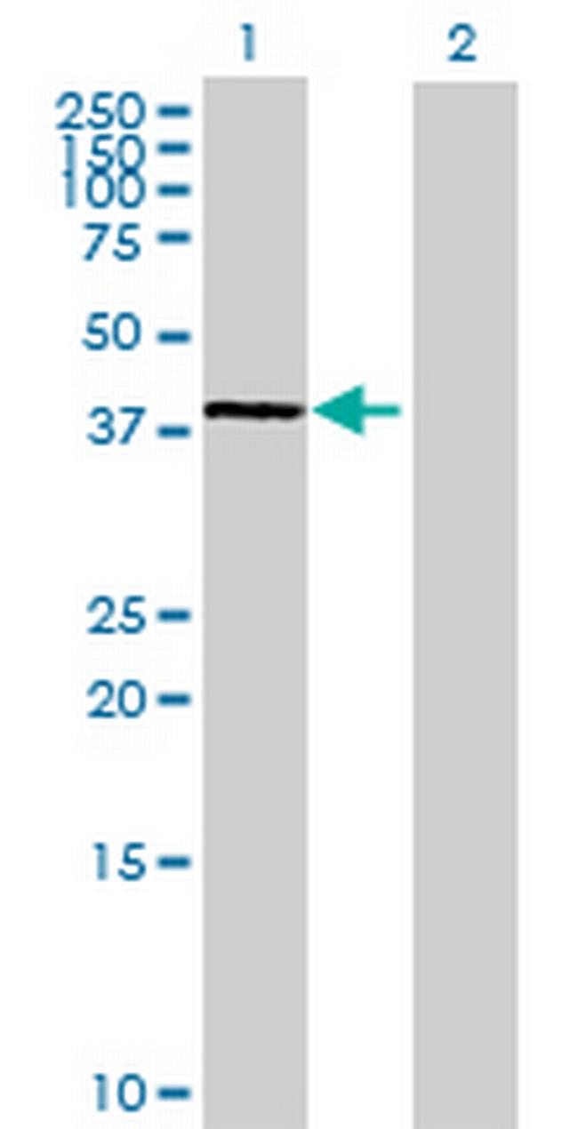 NDN Antibody in Western Blot (WB)