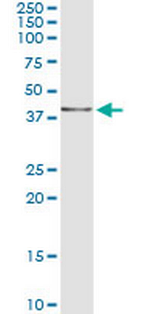 NDN Antibody in Immunoprecipitation (IP)