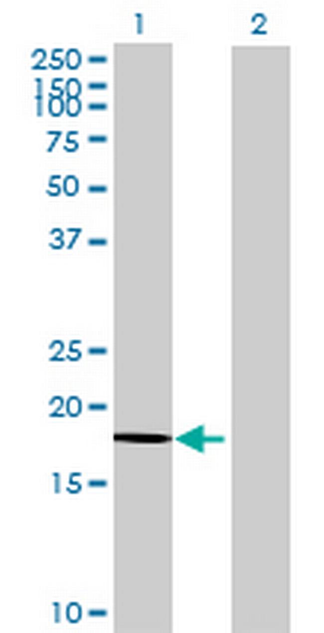 NDUFAB1 Antibody in Western Blot (WB)