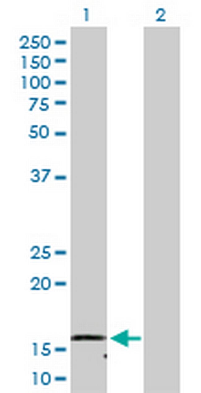 NDUFB1 Antibody in Western Blot (WB)