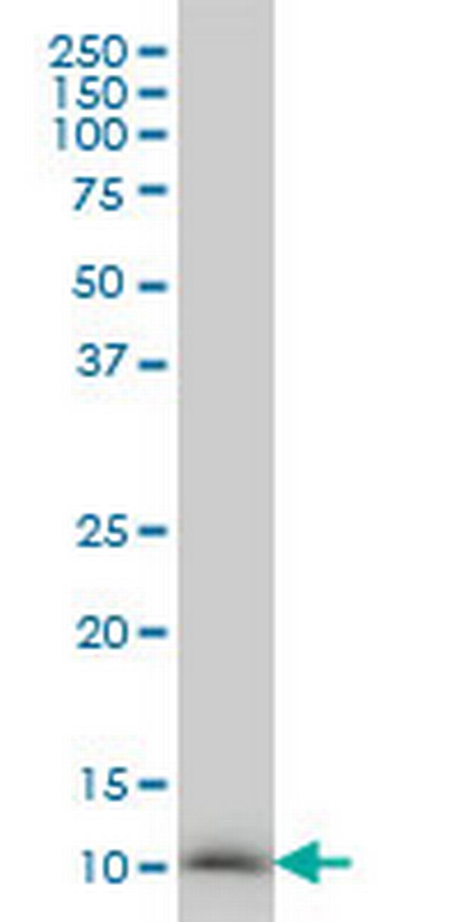 NDUFB3 Antibody in Western Blot (WB)