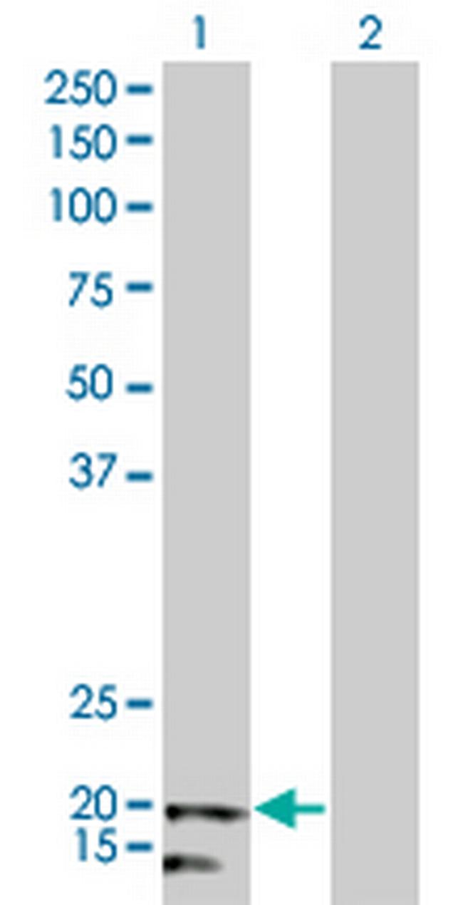 NDUFB5 Antibody in Western Blot (WB)