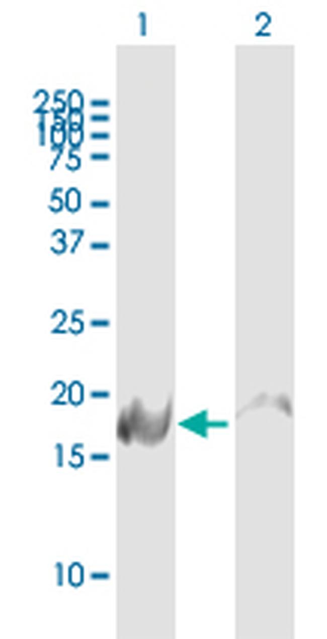 NDUFB6 Antibody in Western Blot (WB)