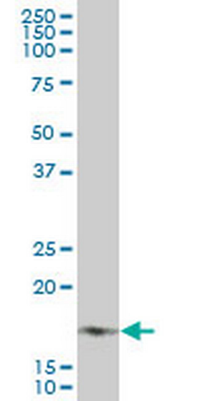 NDUFB7 Antibody in Western Blot (WB)