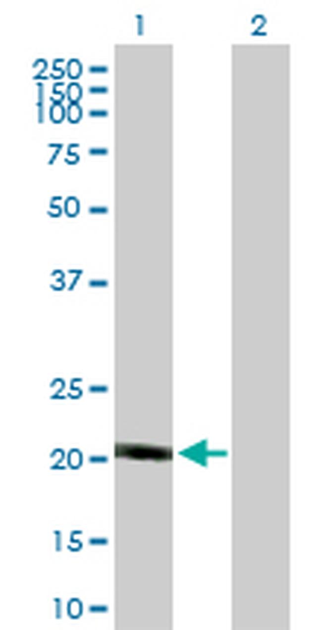 NDUFB10 Antibody in Western Blot (WB)