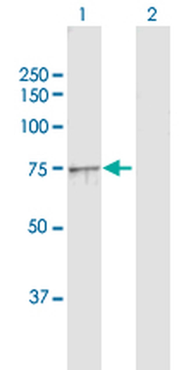 NDUFS1 Antibody in Western Blot (WB)